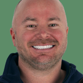   E-Max Veneers